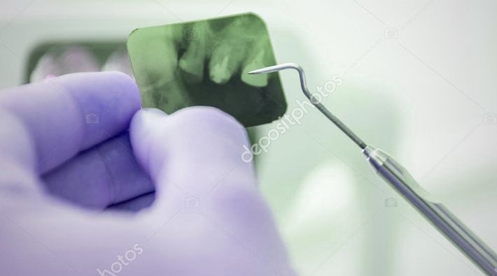 Upis novih pacijenata u ordinacije dentalne medicine